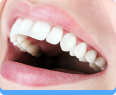 Smile Designing with Ceramic Veneer