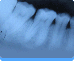 Conservative Dentistry