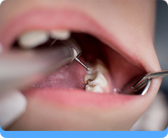 Dental Innovative Treatment