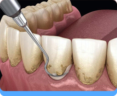 Periodontics