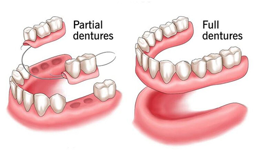 Prosthetic Dentistry