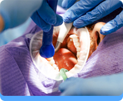 Endodontics - Root Canal Treatment