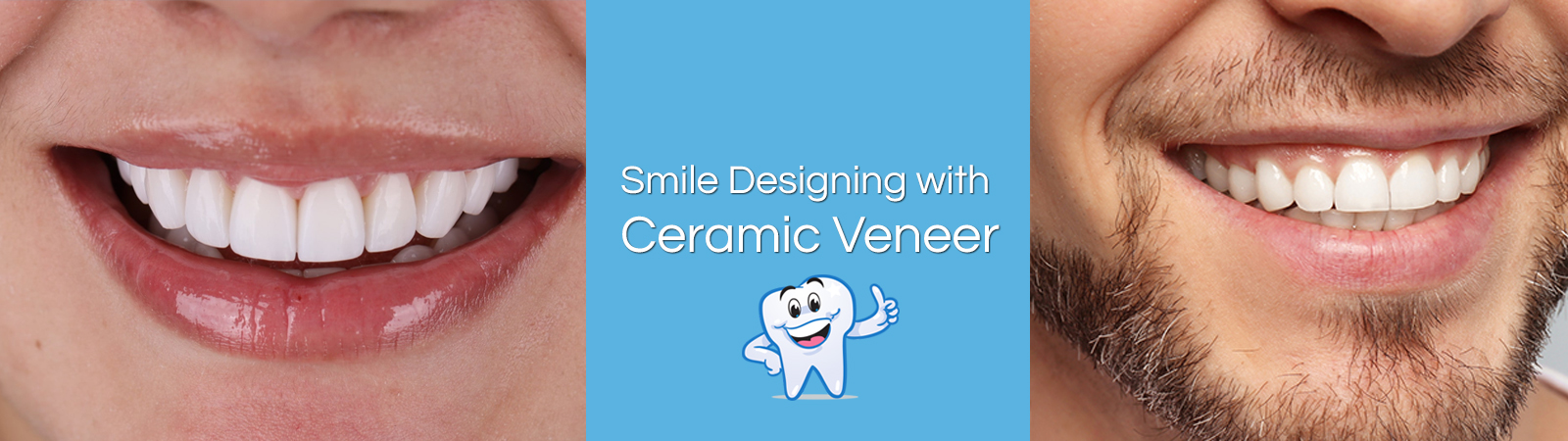 Smile Designing with Ceramic Veneer