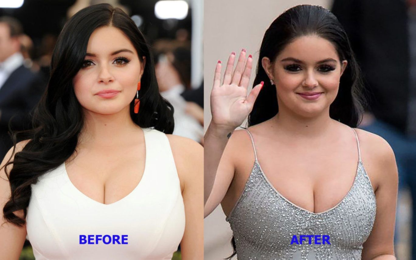 Ariel winter boobjob