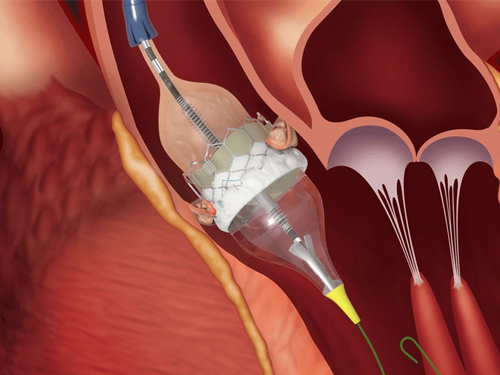 Senior Interventional Cardiologist in EM Bypass Kolkata